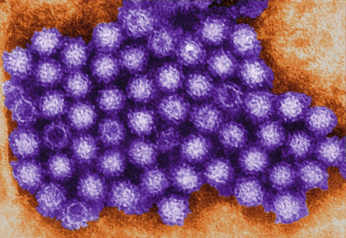 Una micrografia elettronica a trasmissione colorizzata digitalmente che mostra un gruppo di virioni di norovirus in toni viola e arancioni.